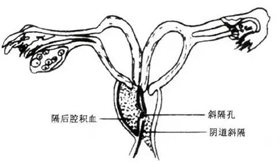 成都不孕不育医院