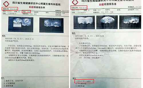 成都治疗输卵管堵塞的医院