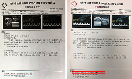 成都子宫内膜异位症怀上宝宝